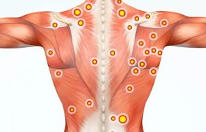 نوار عصب و عضله EMG/NCS - کلینیک امید