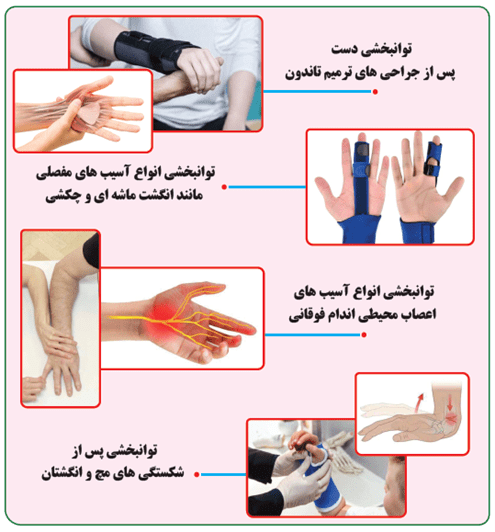 توانبخشی دست - کلینیک امید