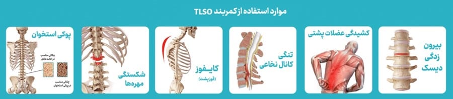 کمربند های LSO & TLSO 