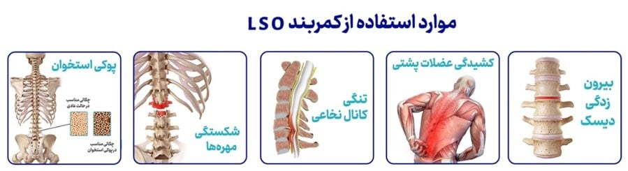 کمربندهای TLSO و LSO