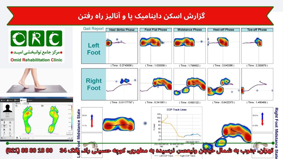 اسکنر داینامیک پا