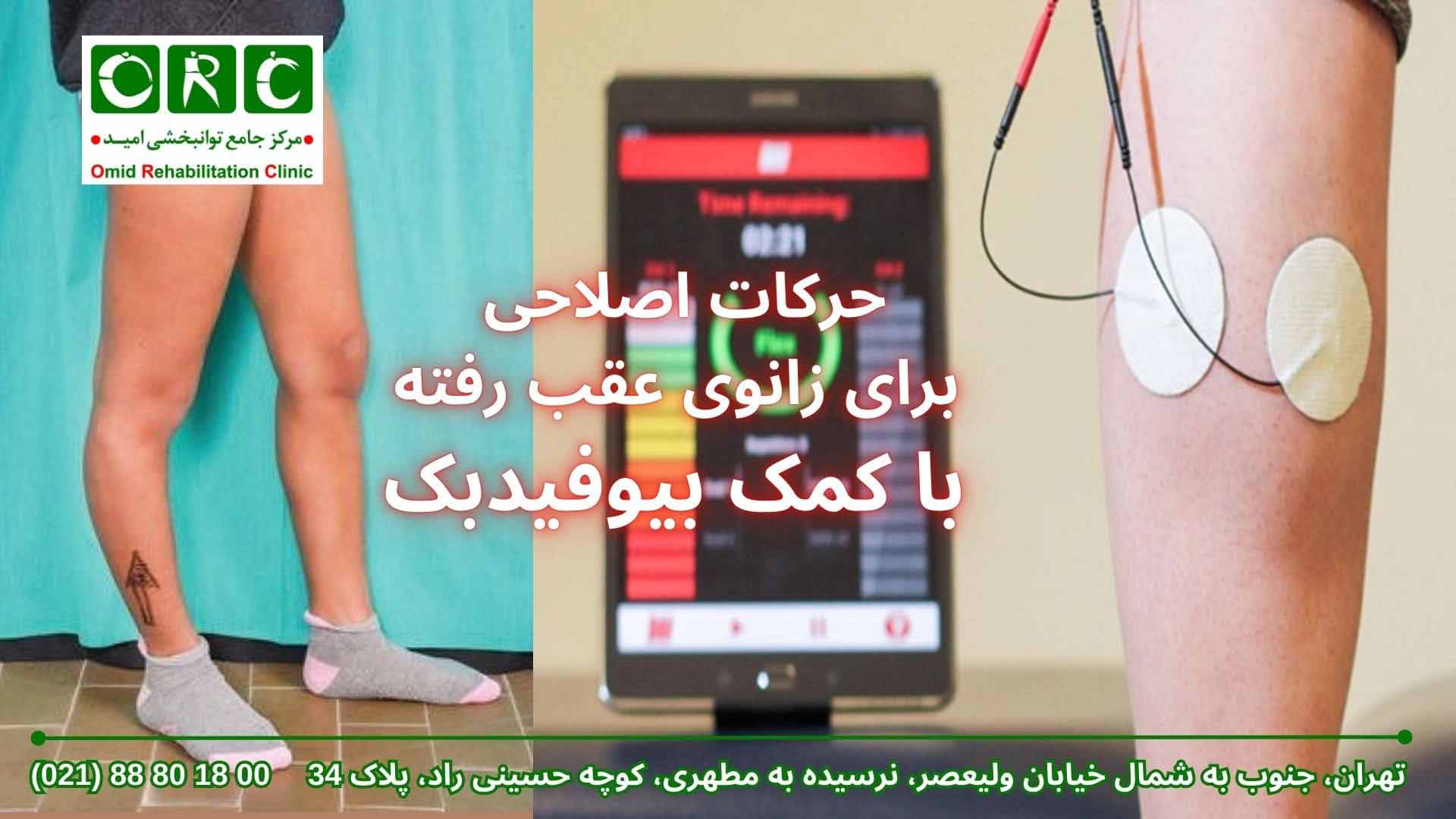 حرکات اصلاحی زانوی عقب رفته