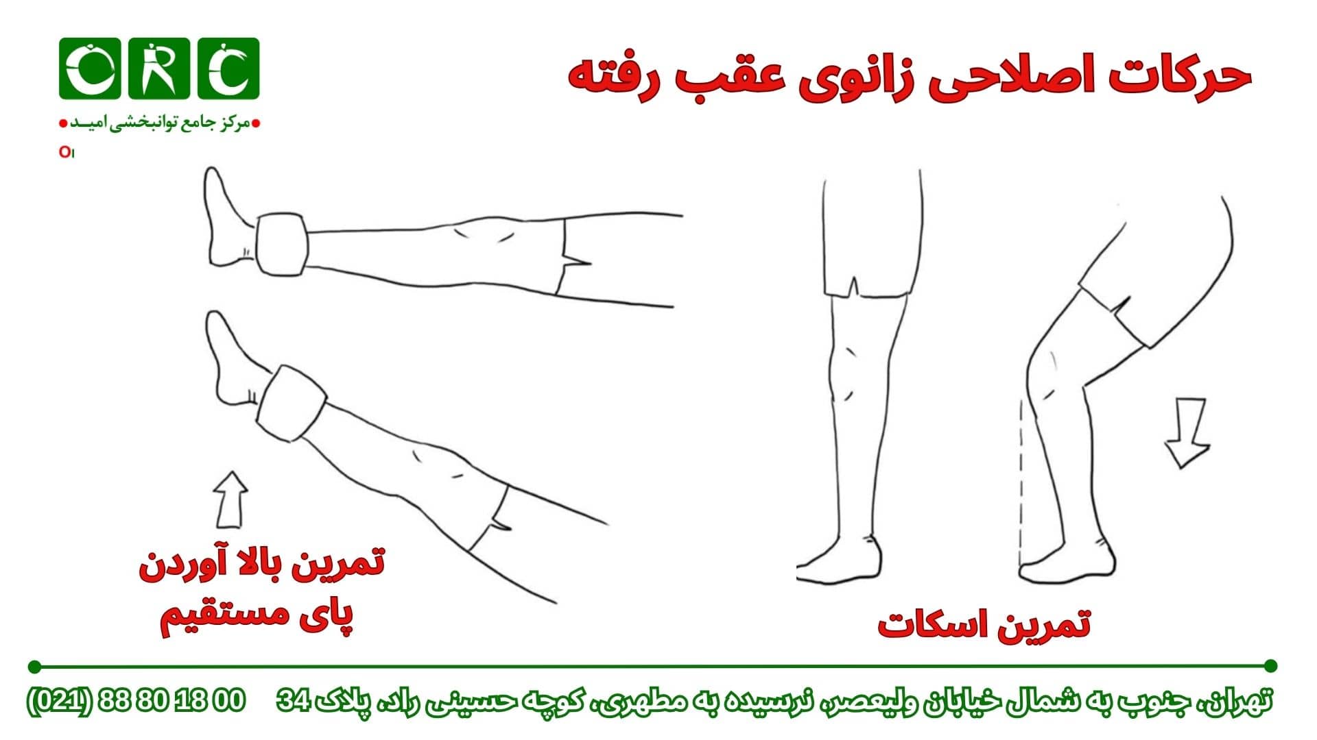 حرکات اصلاحی زانوی عقب رفته