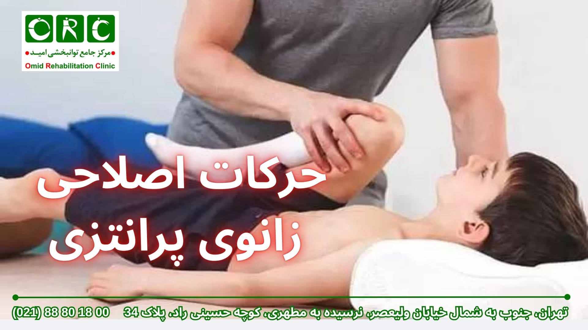 حرکات اصلاحی برای زانوی پرانتزی