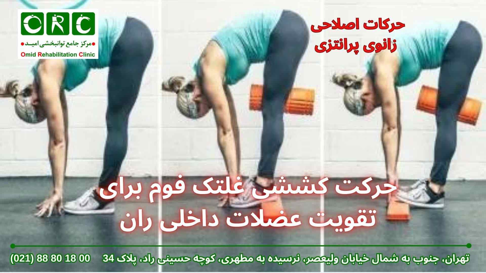 ورزش برای زانوی پرانتزی