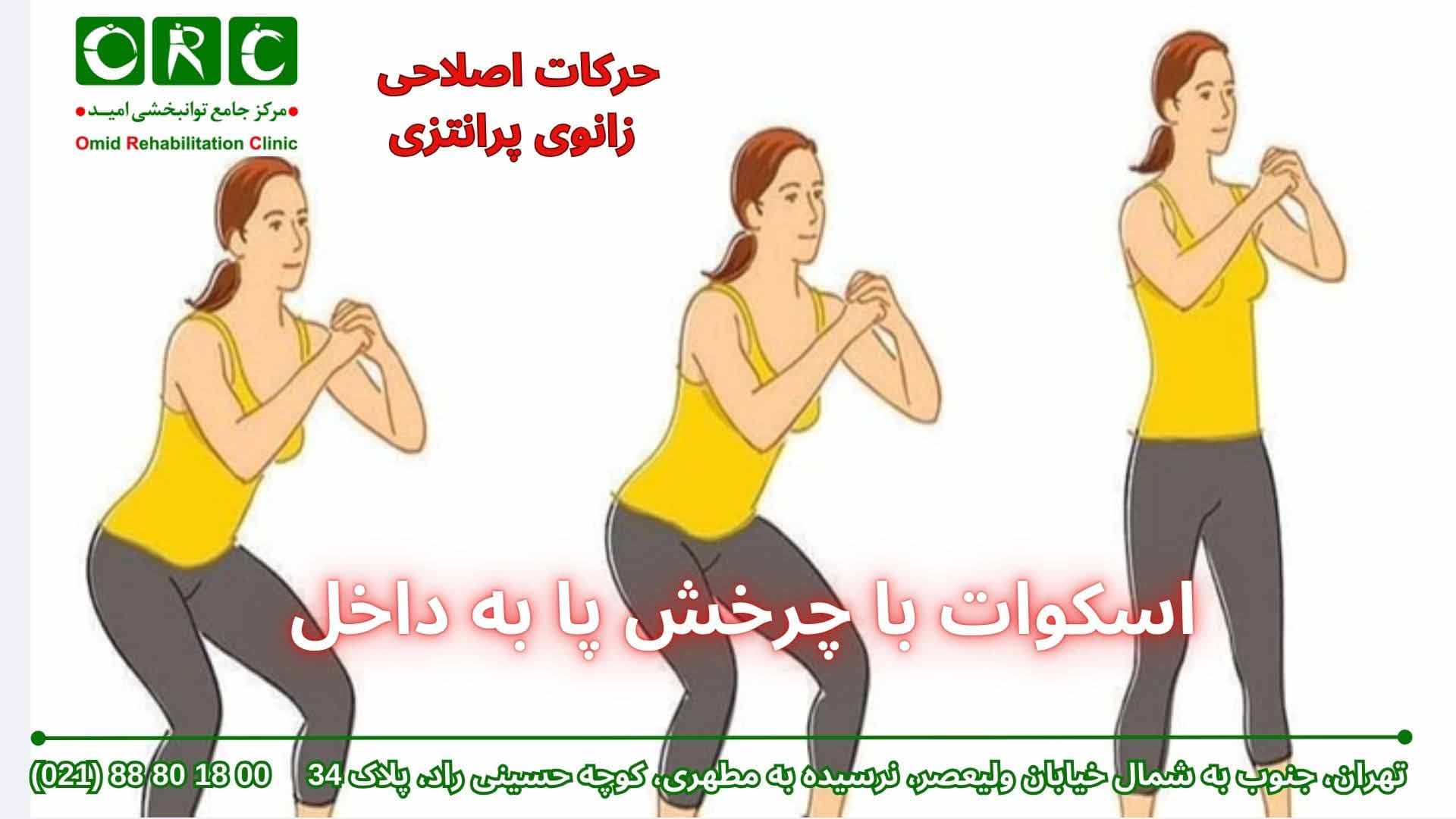 معرفی حرکات اصلاحی پای پرانتزی