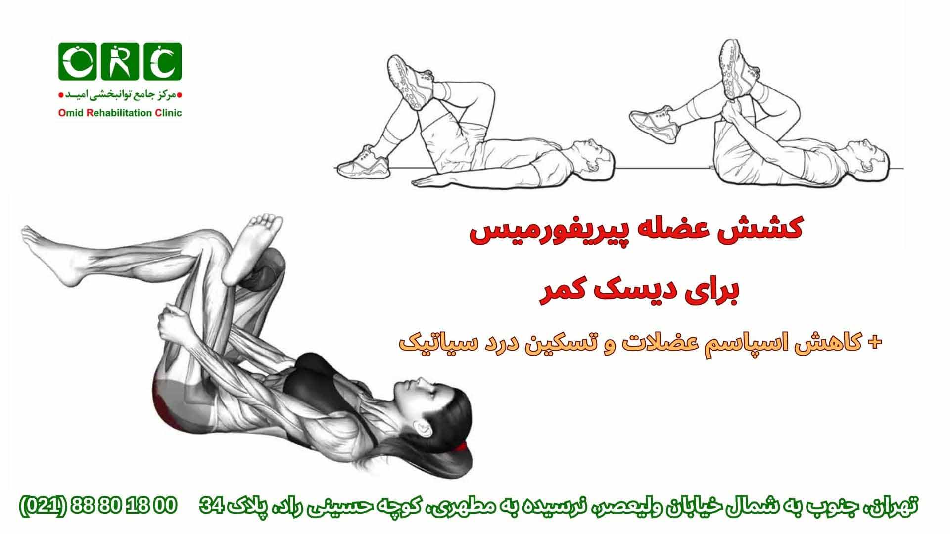 ورزش دیسک کمر مهره 4 و 5