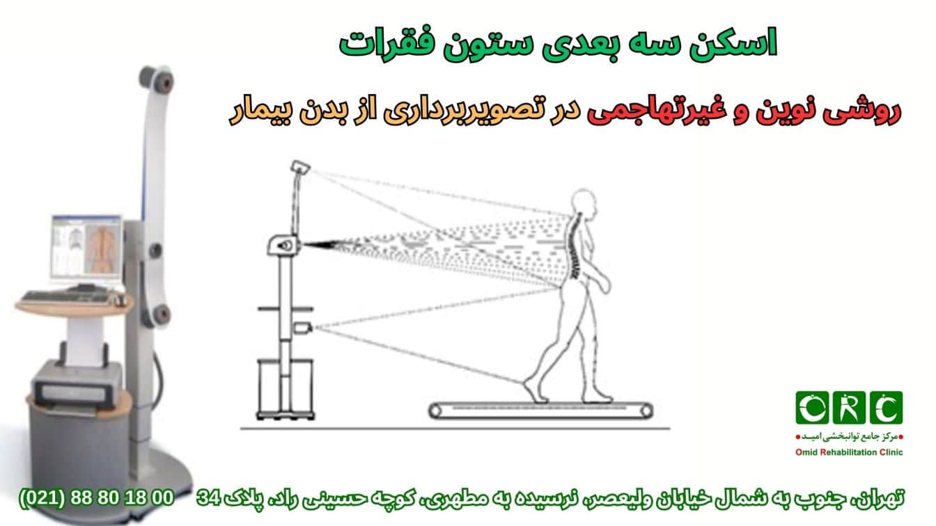 اسکن سه بعدی ستون فقرات