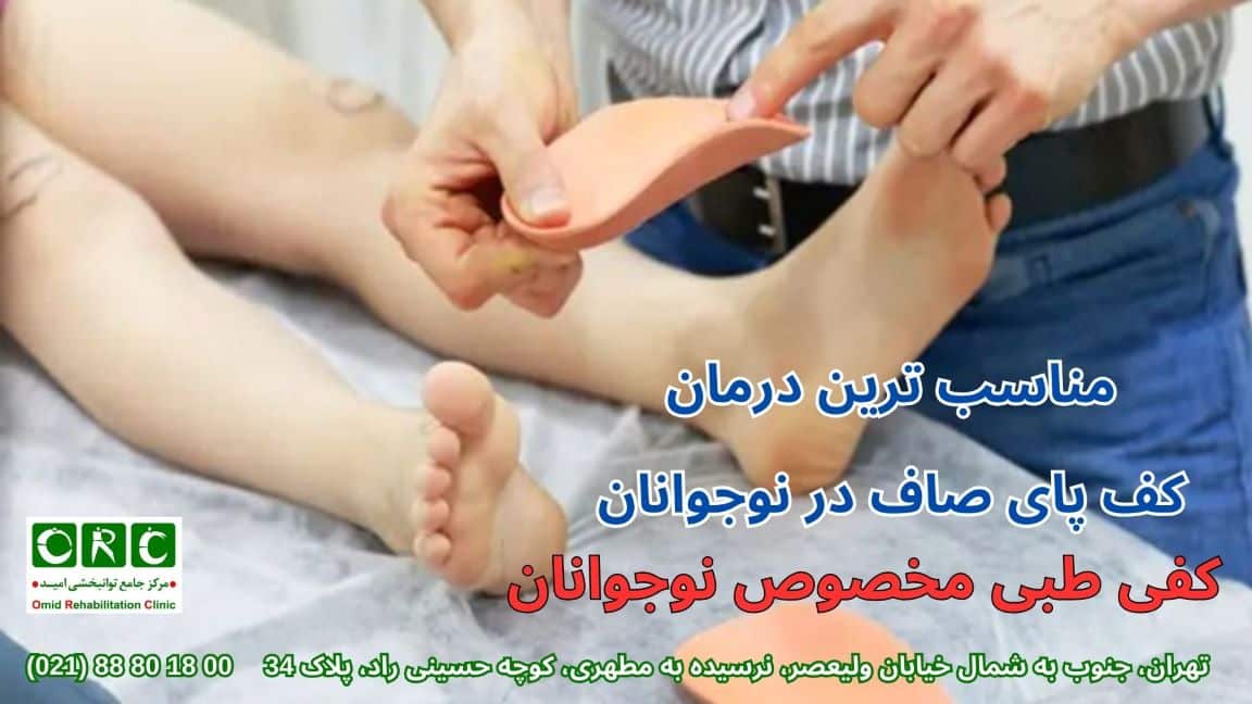 مشکل کف پای صاف در نوجوانان