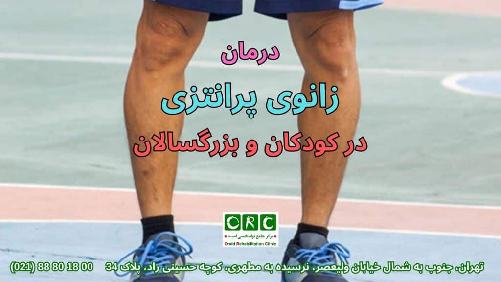 درمان زانوی پرانتزی