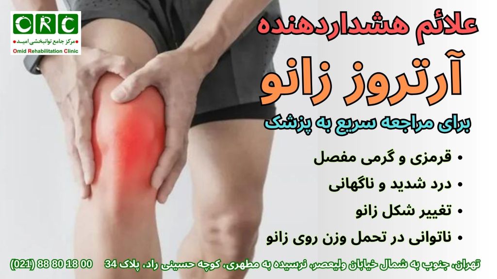درمان آرتروز زانو