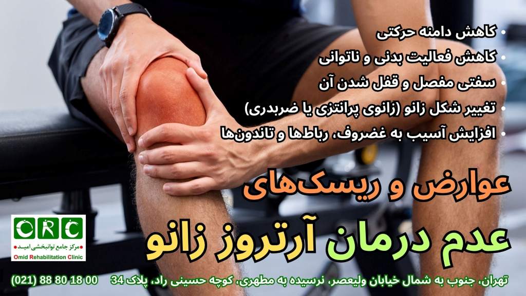 شیوه درمان آرتروز زانو