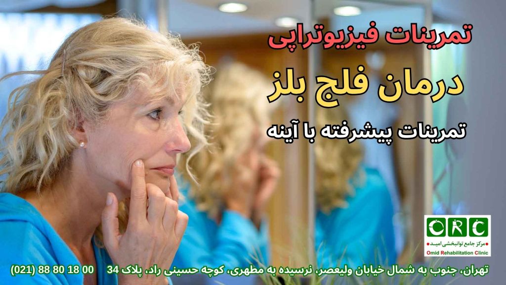 تاثیر فیزیوتراپی فلج بلز