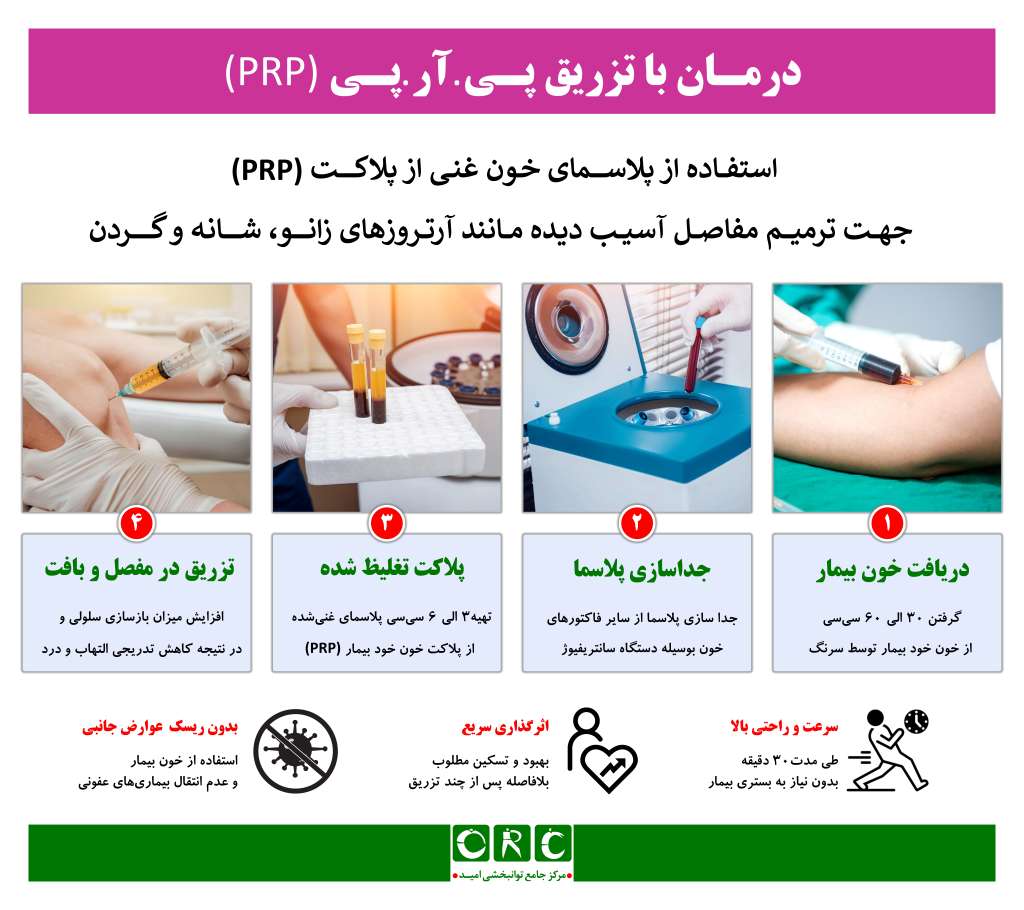 پی آر پی