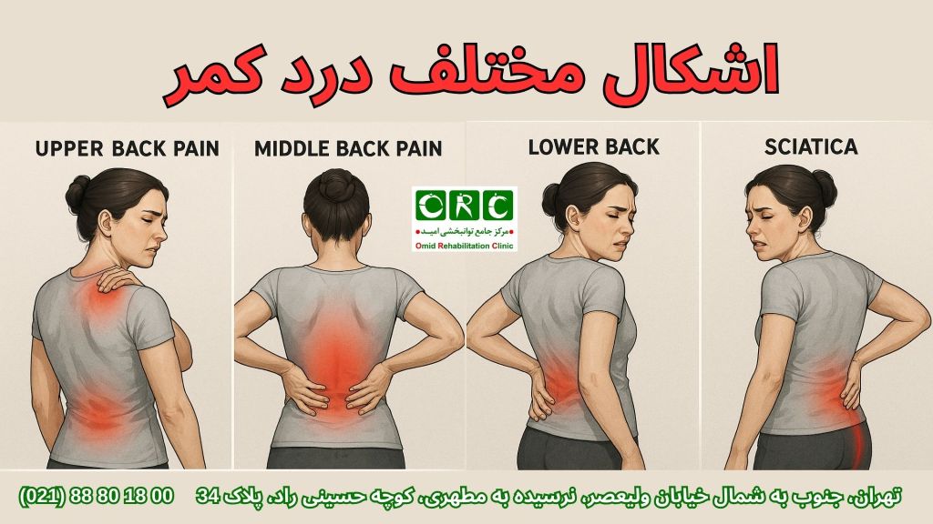 معرفی انواع کمردرد