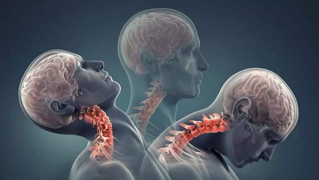 اقدامات توانبخشی ضربه مغزی