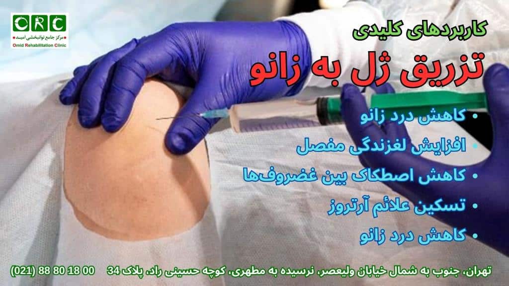 کاربرد تزریق ژل به زانو