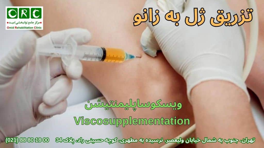 فرآیند تزریق ژل به زانو