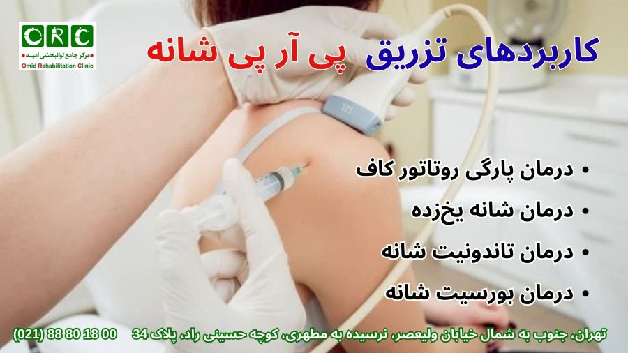 تزریق پی.آر.پی. (PRP) در مفصل شانه کاربرد تزریق پی آر پی شانه